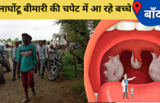 Banda news, 3 children died due to strangulation disease in the village, many more are sick