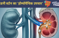 Know homeopathic treatment to cure kidney stone from Dr.RD Yadav of Ayodhya district