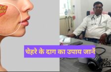 know how to remove facial spots in our show hello doctor